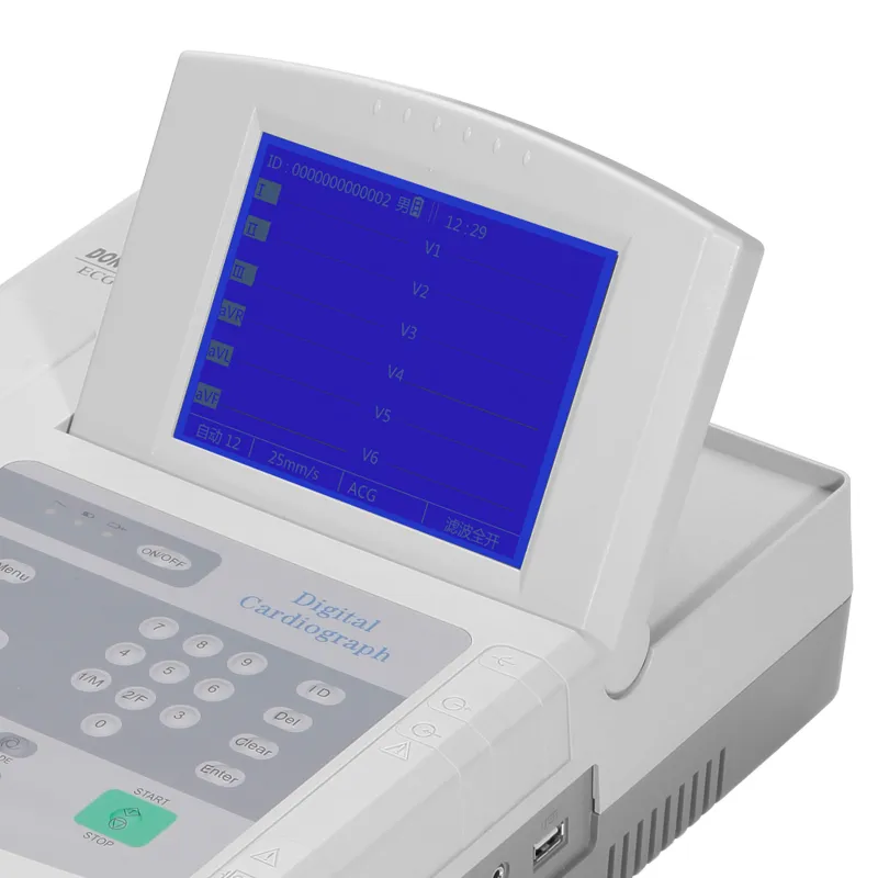 ECG Detalle 4