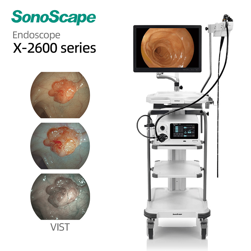 Sistema de Endoscopia Médica SonoScape X-2600 con Estación de Trabajo Compacta
