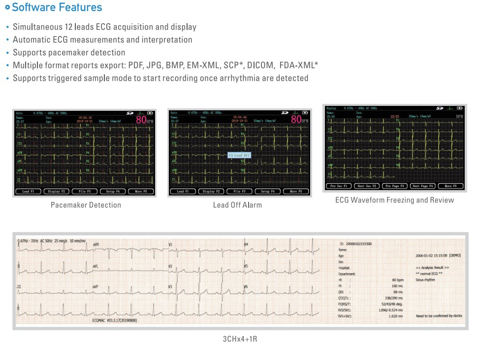 Máquina de ECG portátil con impresora 3 canal electrocardiograma 12 derivación