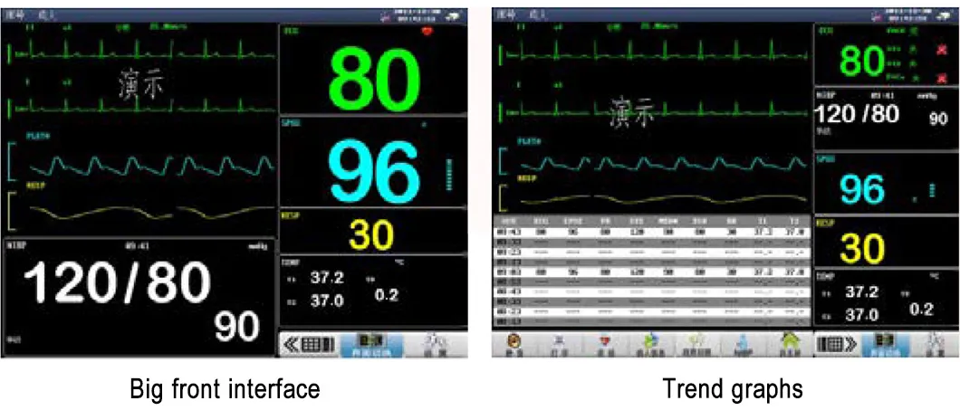 Precio del Monitor de Paciente Médico Inalámbrico Flexible de Luz Quirúrgica en la UCI