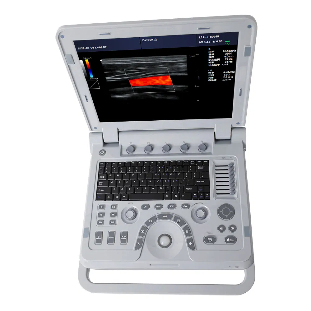 Máquina de Ultrasonido Veterinario Premium con Tecnología Doppler Color