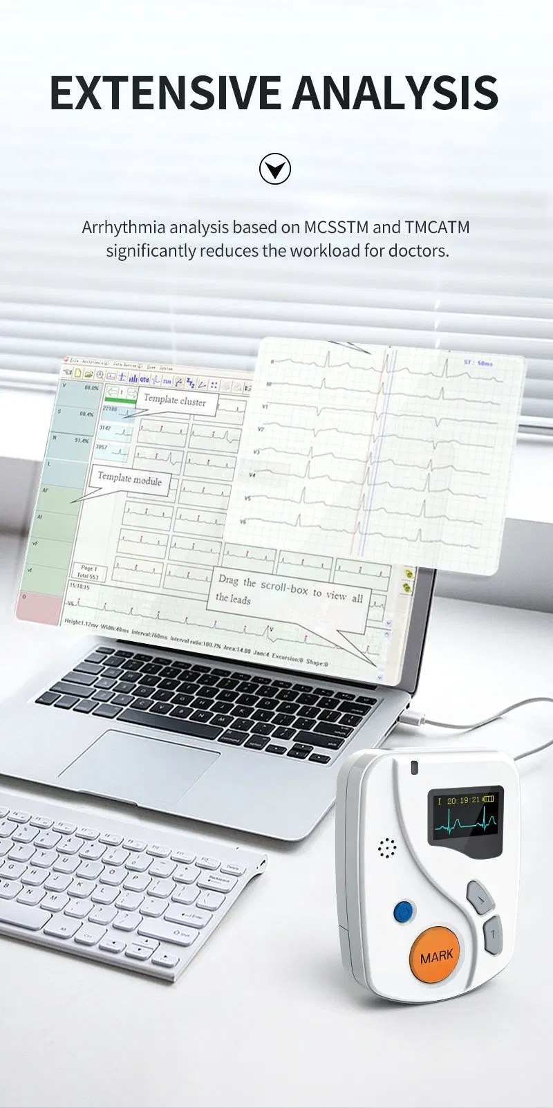 TLC6000 Holter ECG 5