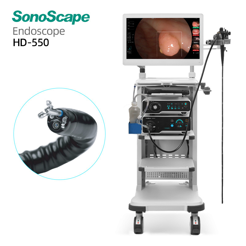 Sistema de Endoscopia Médica Sonoscape HD-550 con Sensor CMOS de Iluminación LED para Diagnóstico Gástrico 4 Full HD 1080P