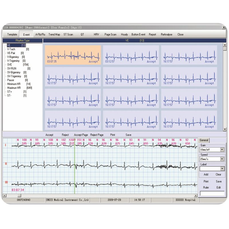 Equipo Médico de ECG Ambulatorio Portátil 12 Canal 24hour Monitor Holter de ECG