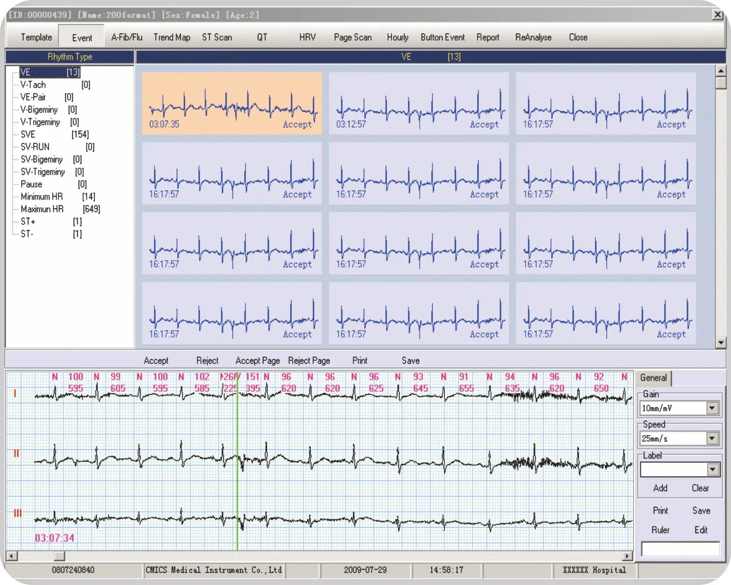 Venta Caliente 12 Monitor Holter ECG de 24 Hora Monitor Holter ECG 12 Canal