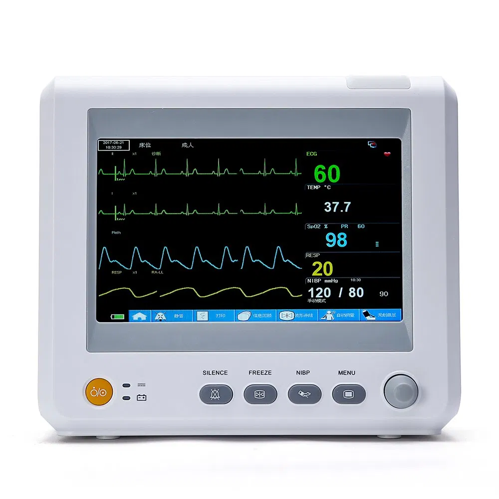 Precios bajos en equipo veterinario monitor multiparamétrico con ECG/SpO2/NIBP