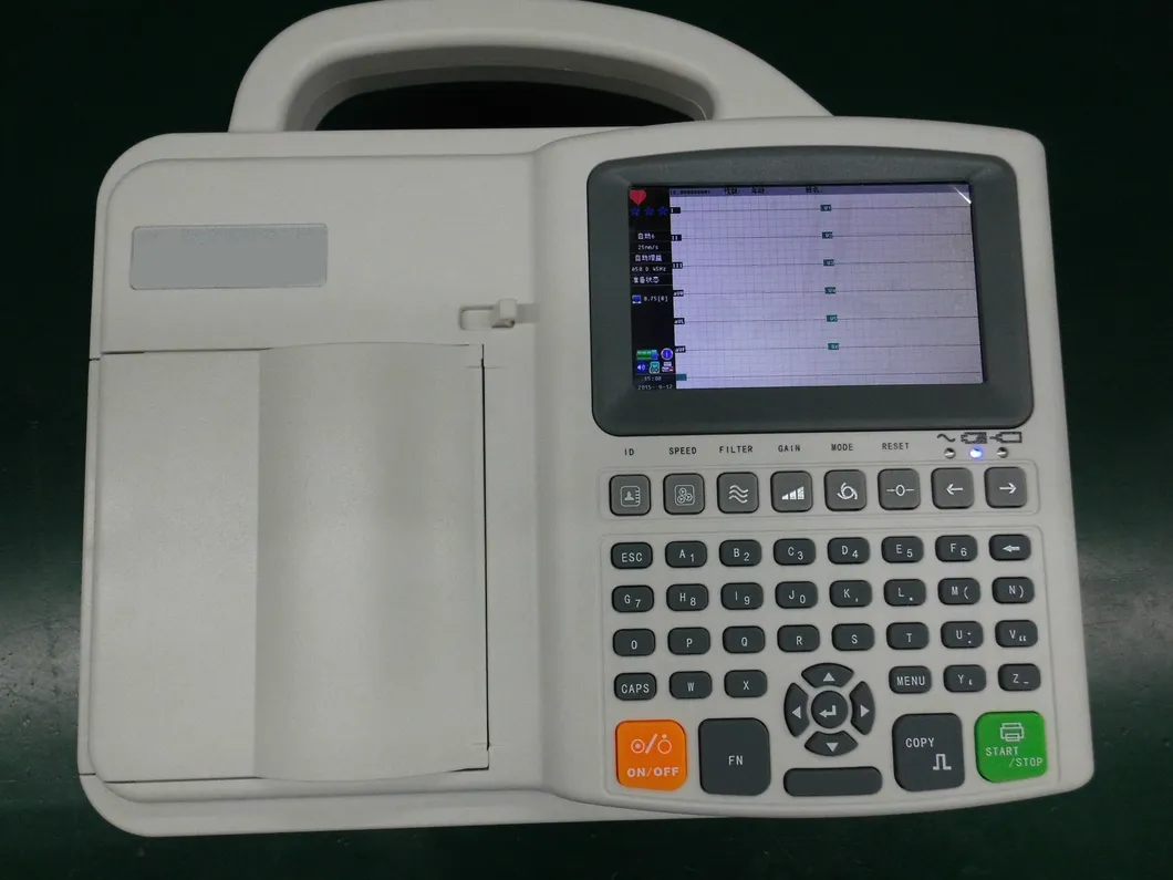 ECG Machine View 4