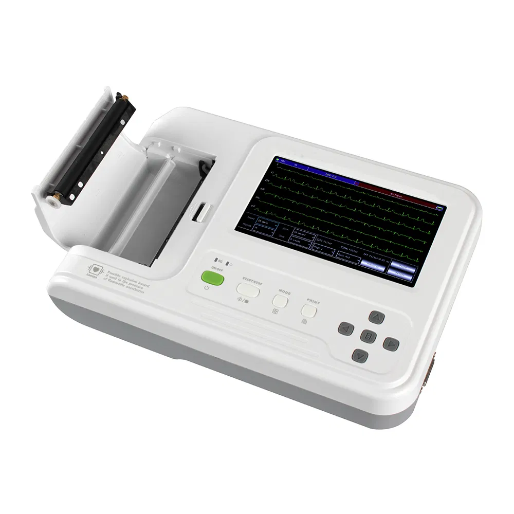 Máquina de Electrocardiografía ECG Basada en PC a Precio Económico 12 Leads 6 Canales con Análisis Diagnóstico en Tiempo Real