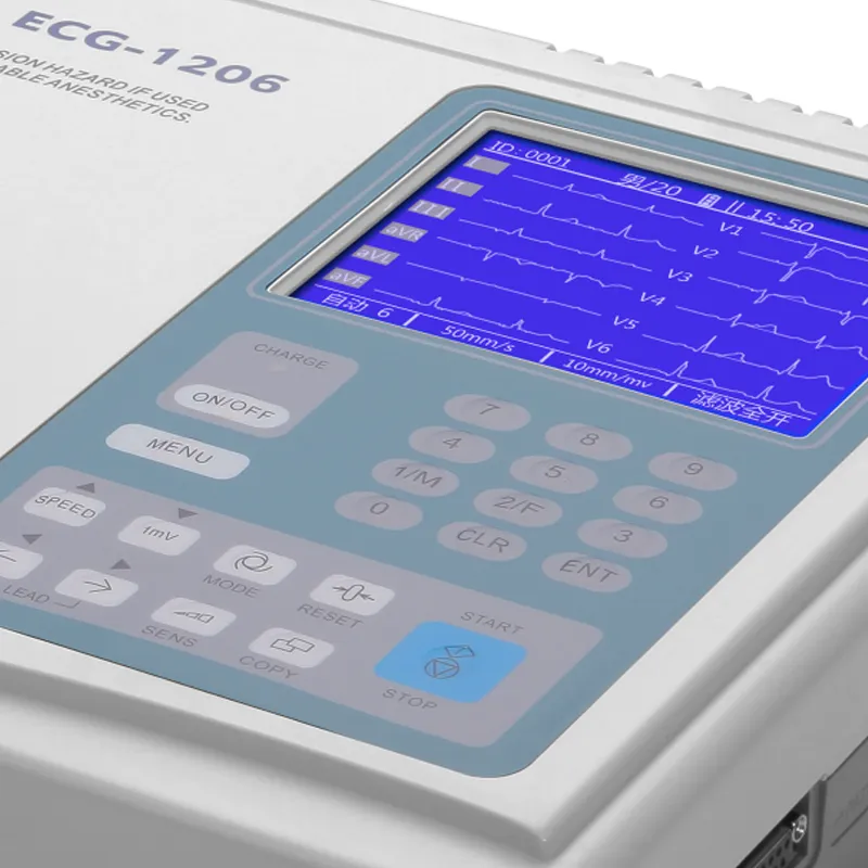 Detalle ECG 4