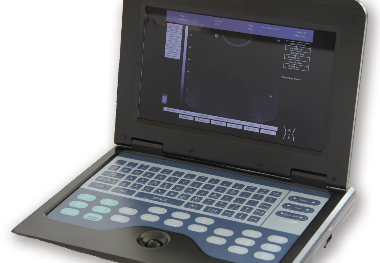 Contec Cms600p2 Cuaderno de Equipos Médicos del Hospital Sistema de Ultrasonido Diagnóstico