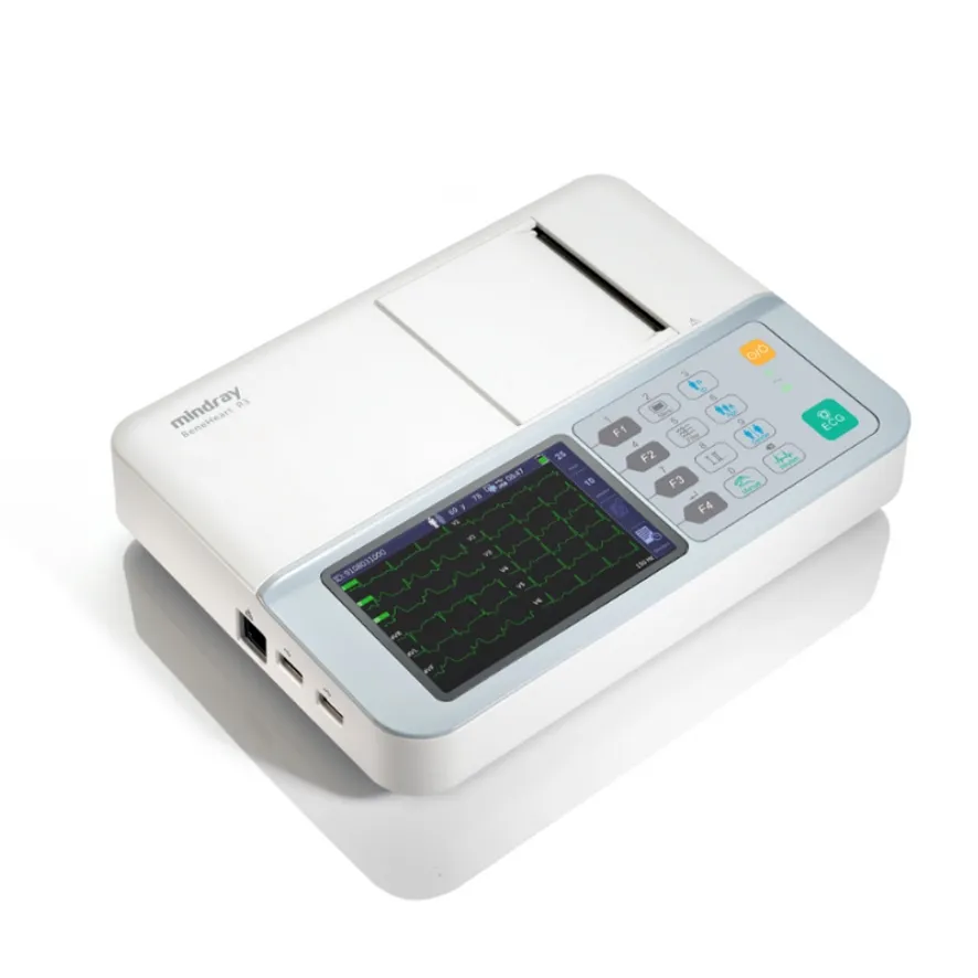 Detalle ECG 1