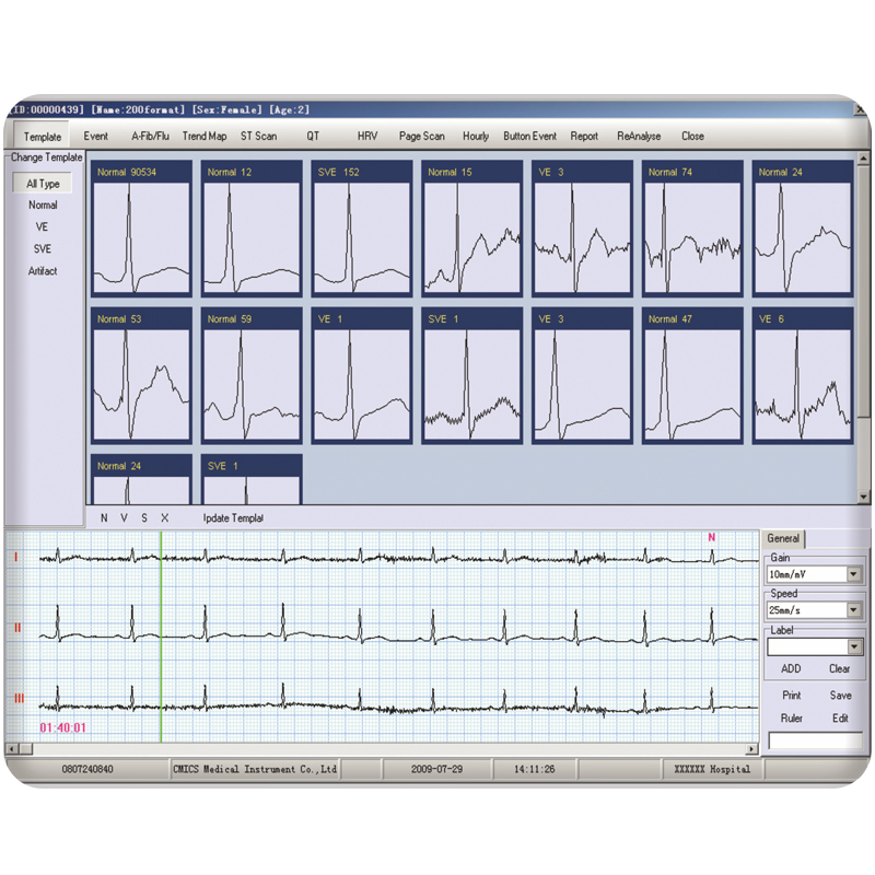 Equipo Médico de ECG Ambulatorio Portátil 12 Canal 24hour Monitor Holter de ECG