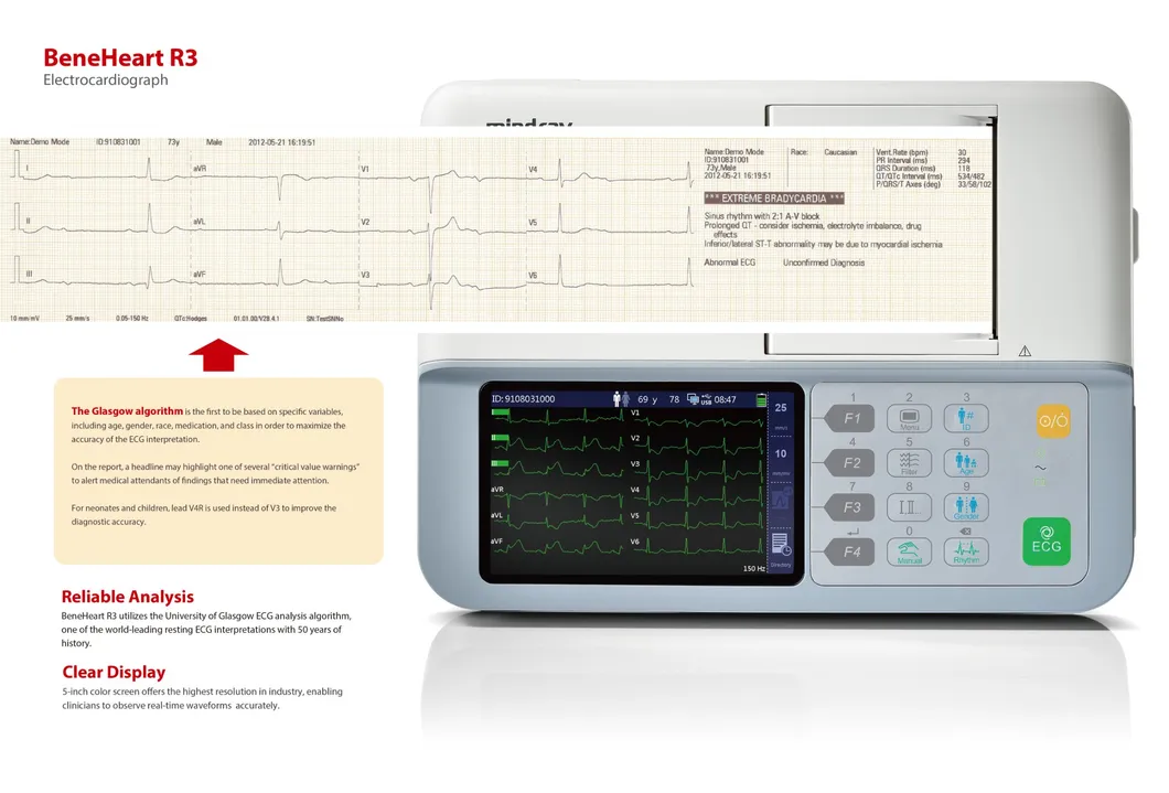Análisis de ECG