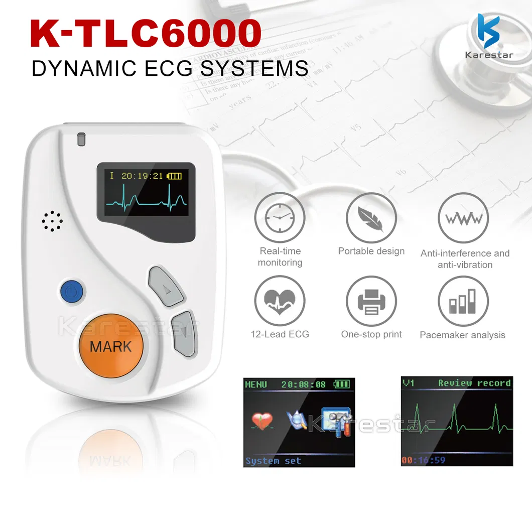 Holter ECG detail