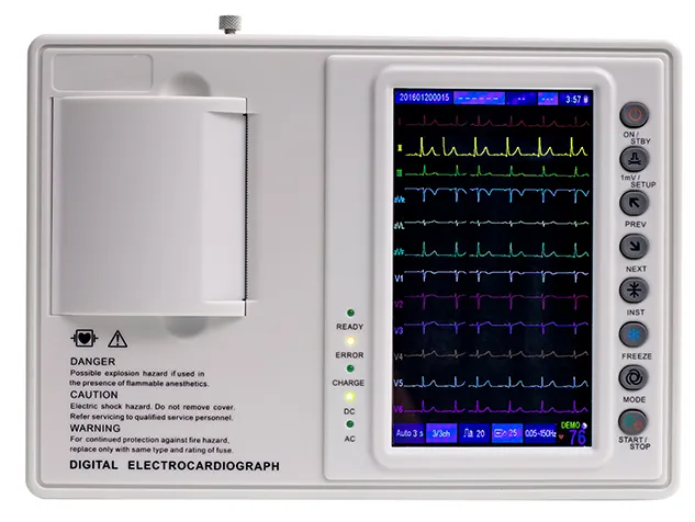 Detalle pantalla ECG