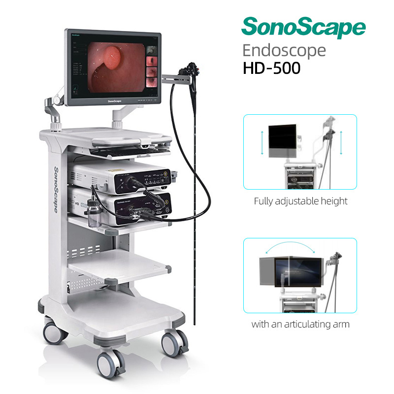 Sistema de Endoscopia Hospitalaria Sonoscape Certificado CE HD-500 Versátil Inteligente de Tinción Potenciado para Exámenes Gi Mínimamente Invasivos