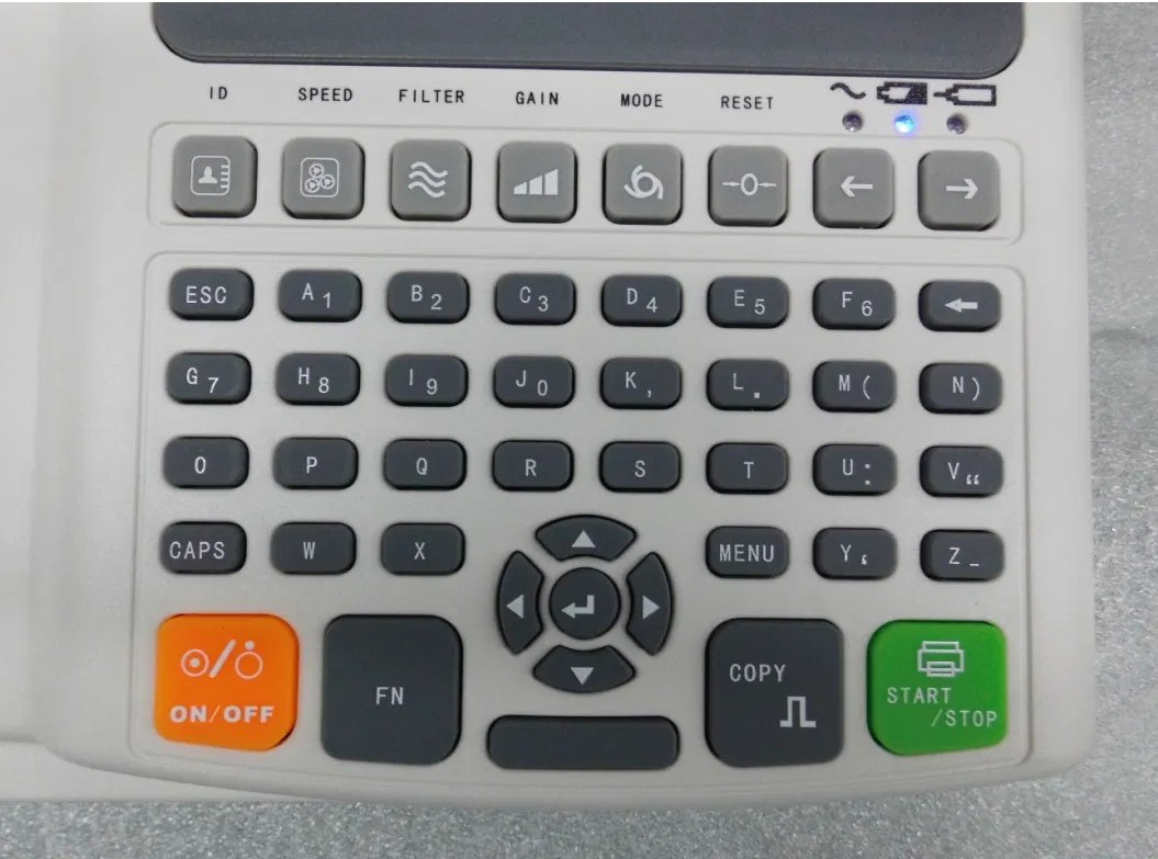 3 Monitoreo Electrocardiográfico de Pantalla Táctil Digital de Canales E3