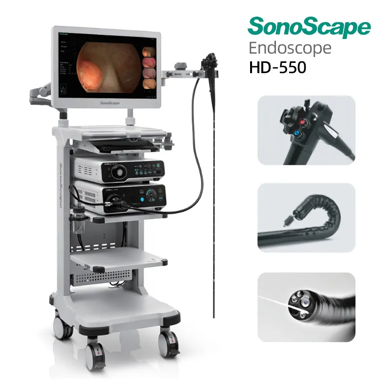 Sonoscape HD-550 1
