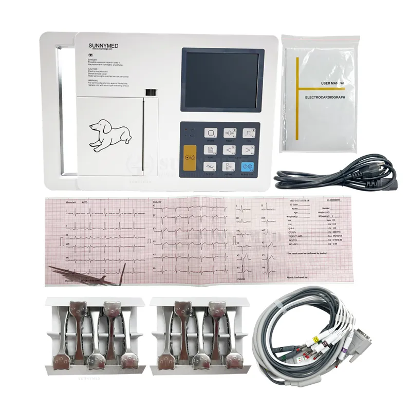Detalle ECG 1