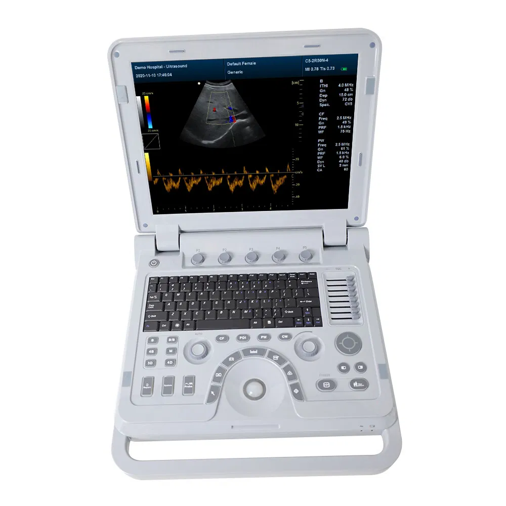 Máquina de Ultrasonido Veterinario Premium con Tecnología Doppler Color