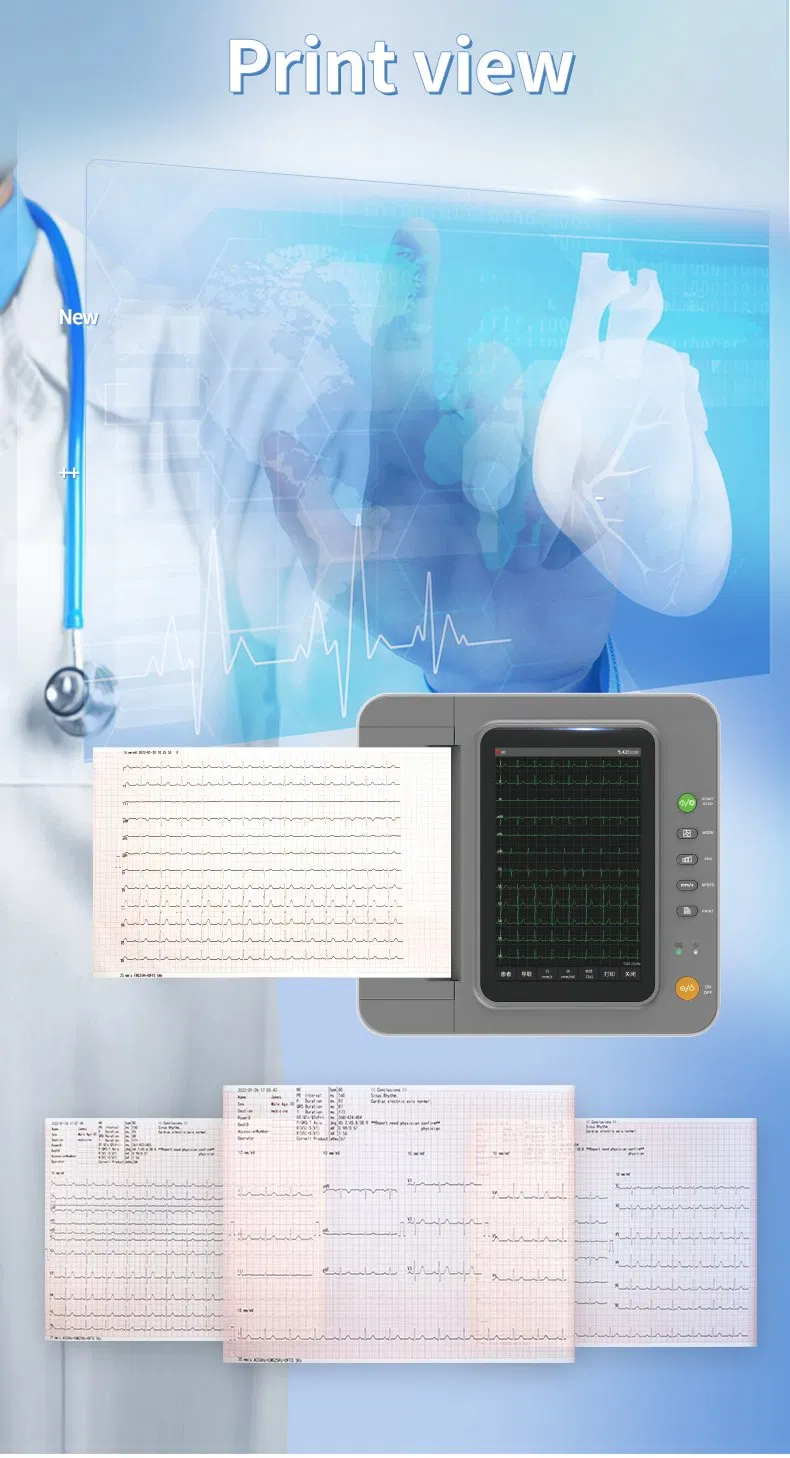 ECG detalle 5