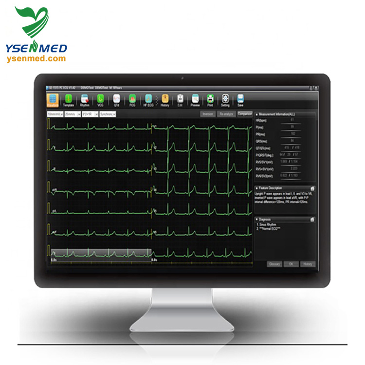 Explorador de ECG Centralizado Edan Brand ECG Se-1515 Máquina de ECG