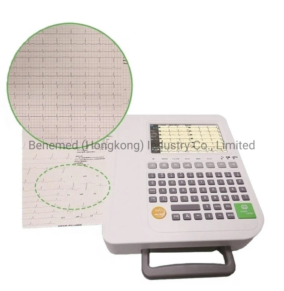 Detalle ECG