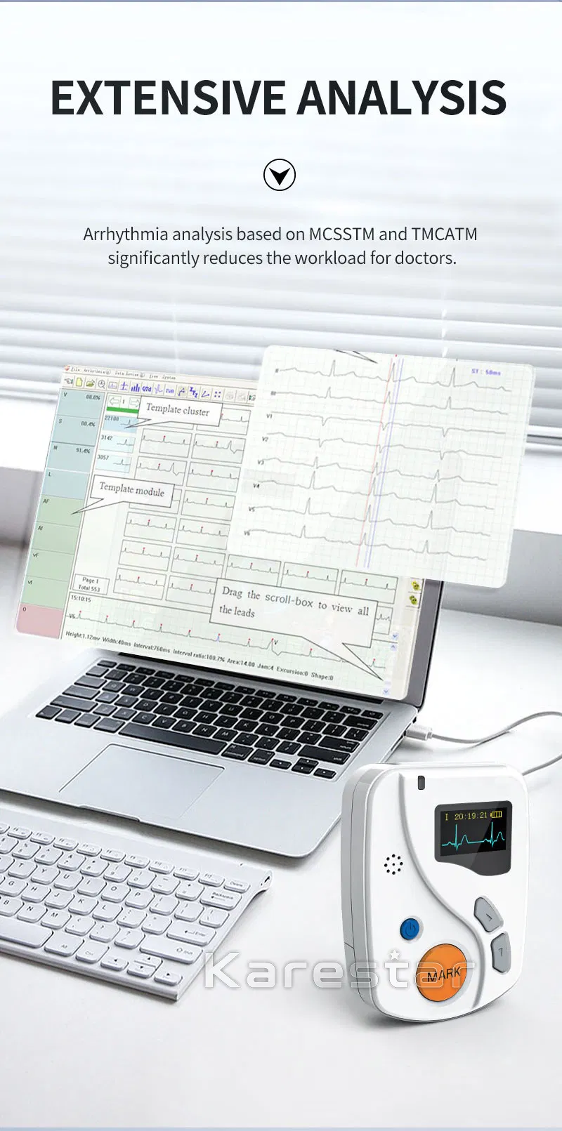 ECG report