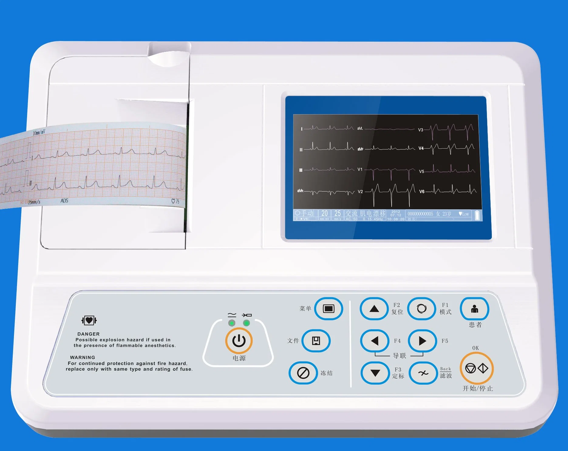 Máquina de ECG de canal hospitalario 6 con certificado Ce, ISO (EKG06A)