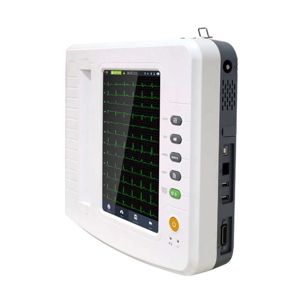 Monitor de ECG Avanzado 12-Channel con Pantalla a Color para Profesionales