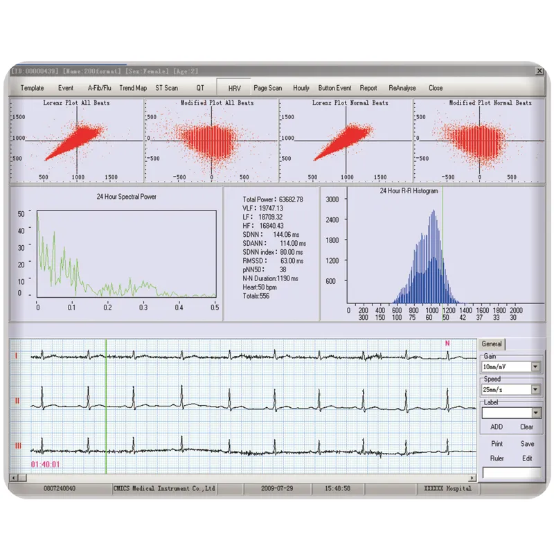 Detalle Monitor Holter 3