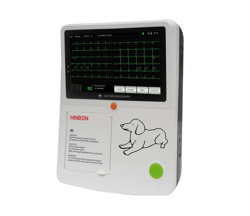 Detalle ECG 1