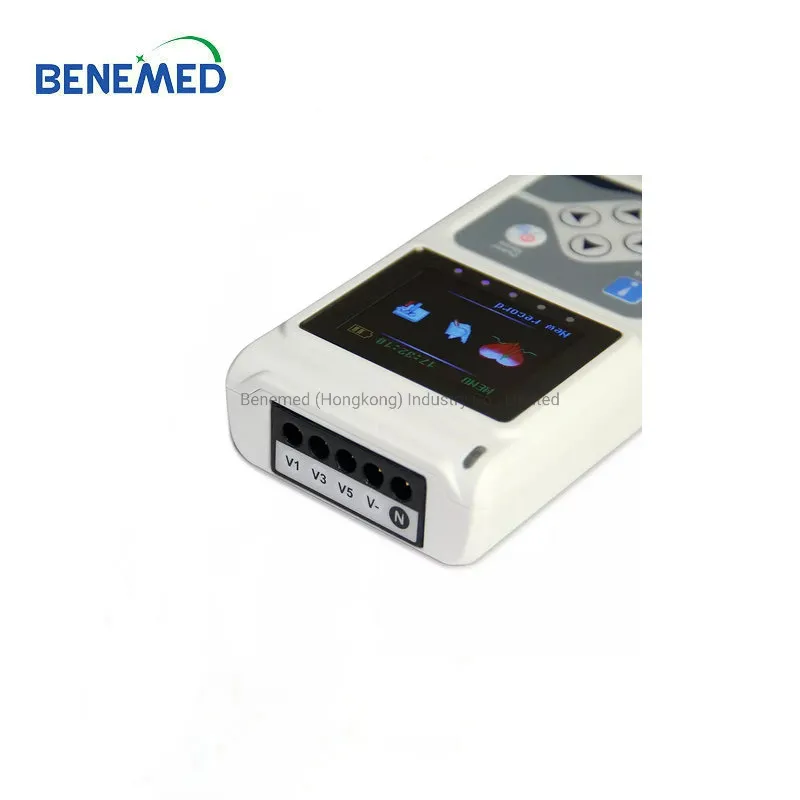 Detalle ECG 6
