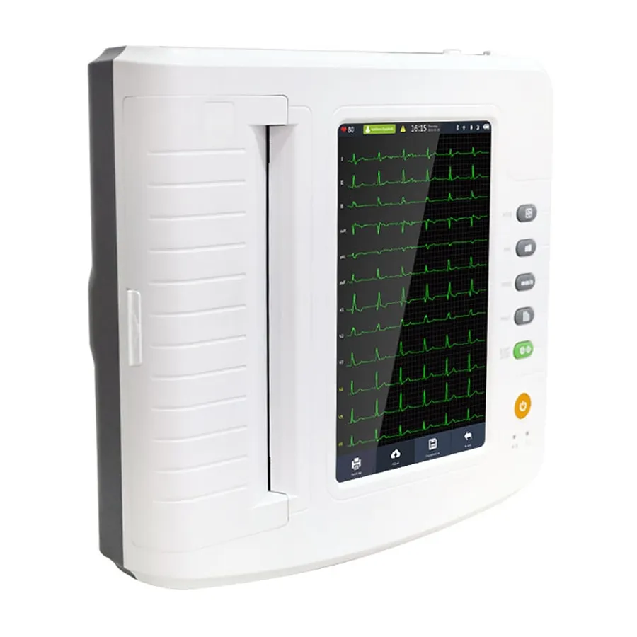 Detalle ECG 2