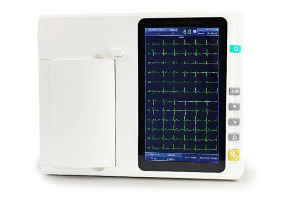 ECG Display