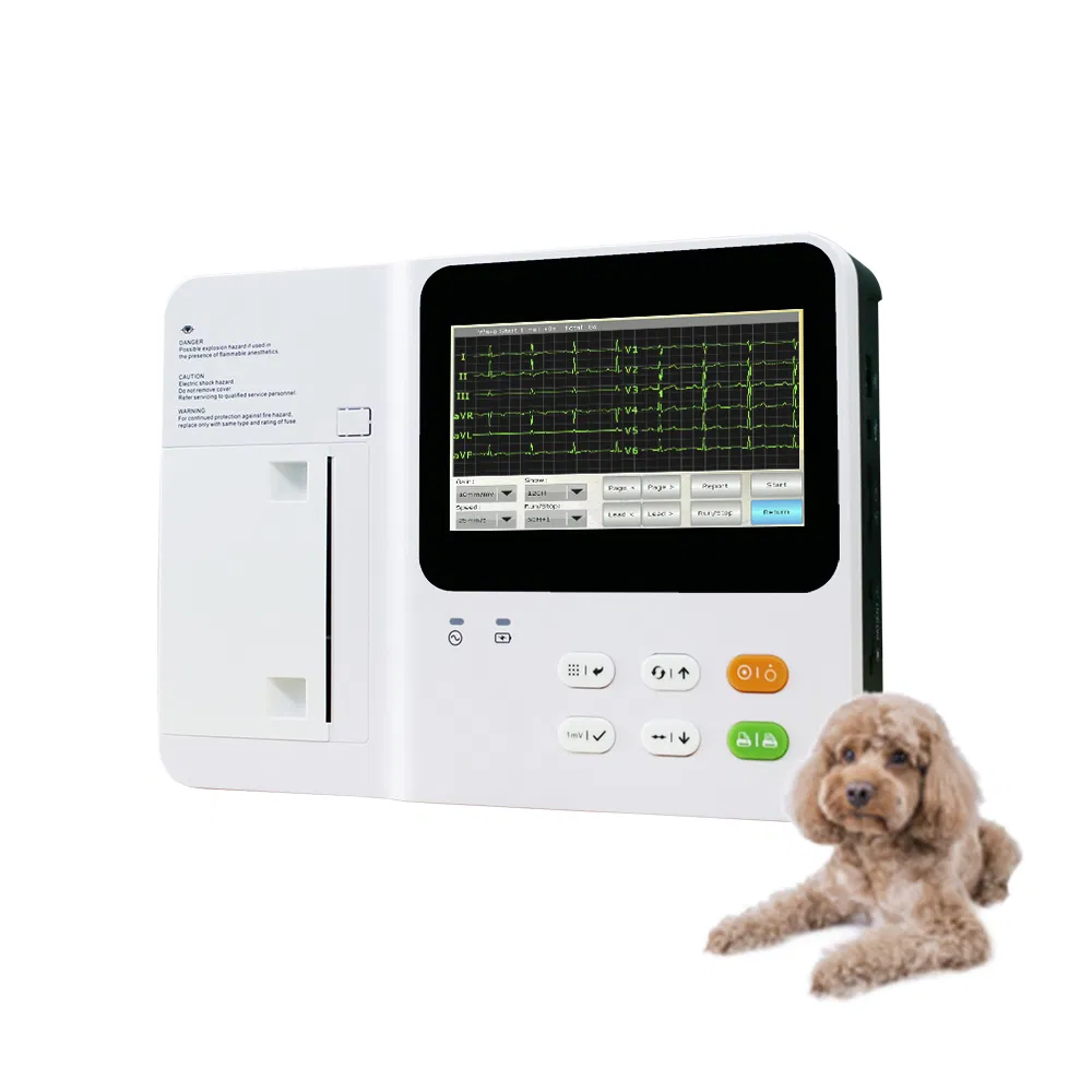 Monitor ECG inalámbrico para monitoreo continuo del corazón y compartición de datos