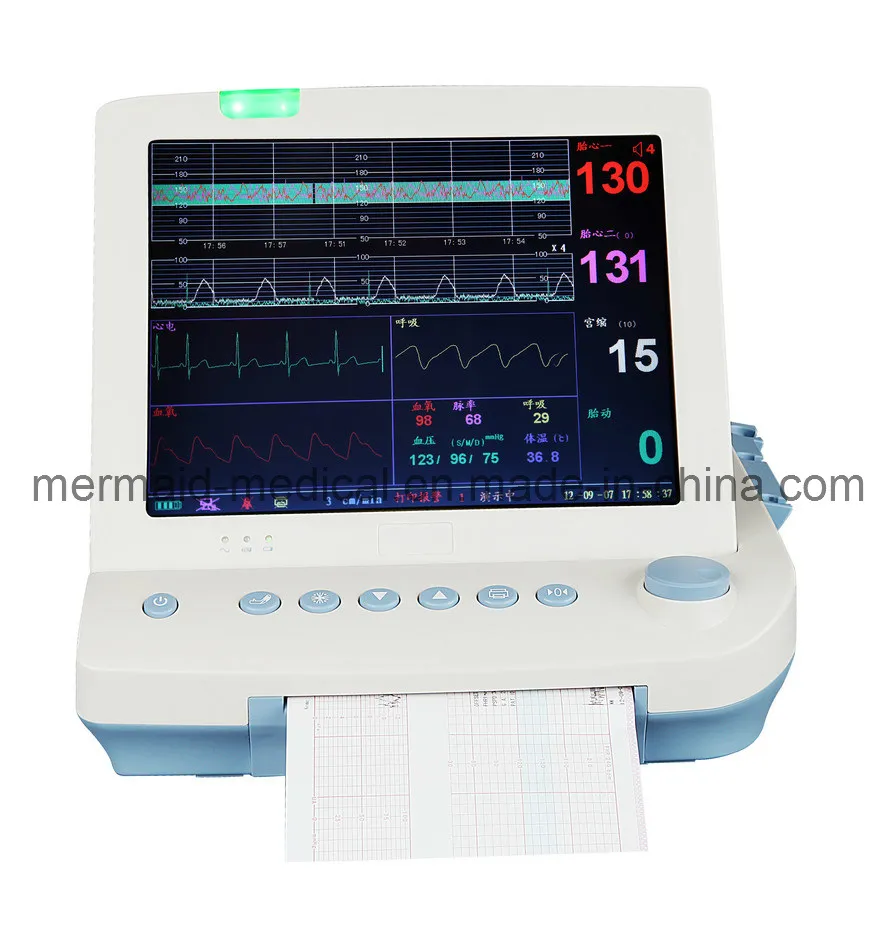 Monitor de ECG fetal