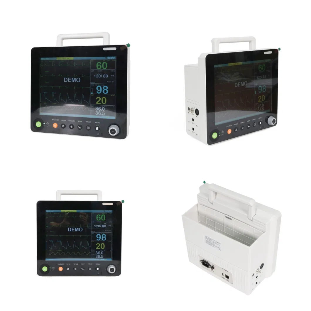 Detalle Monitor