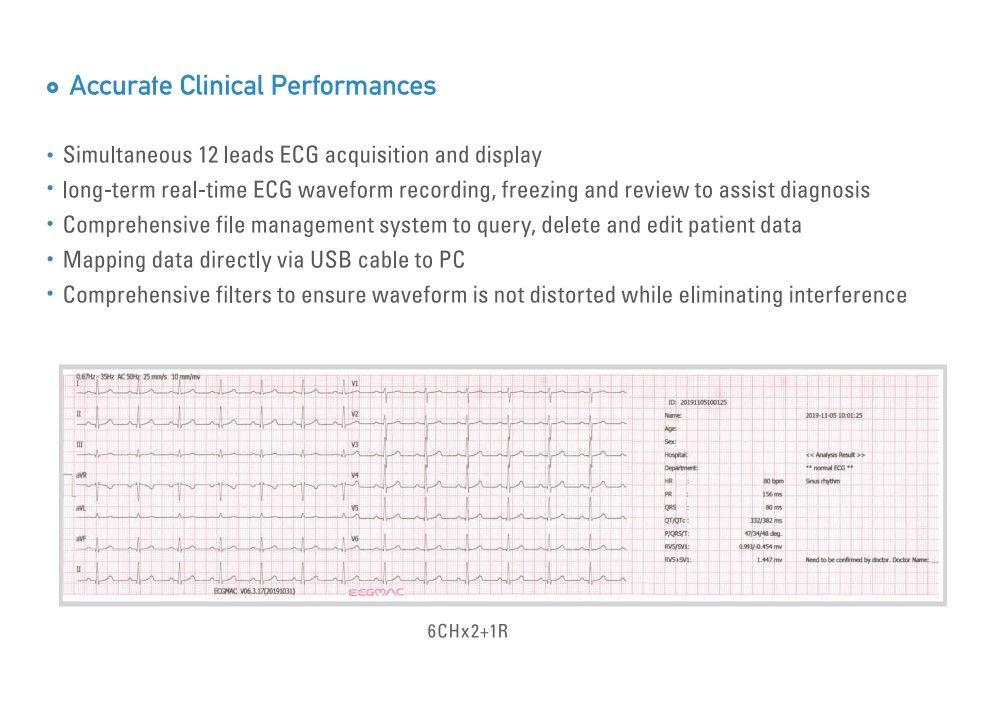 Máquina de Electrocardiografía ECG Portátil 12 Dispositivo Médico Profesional