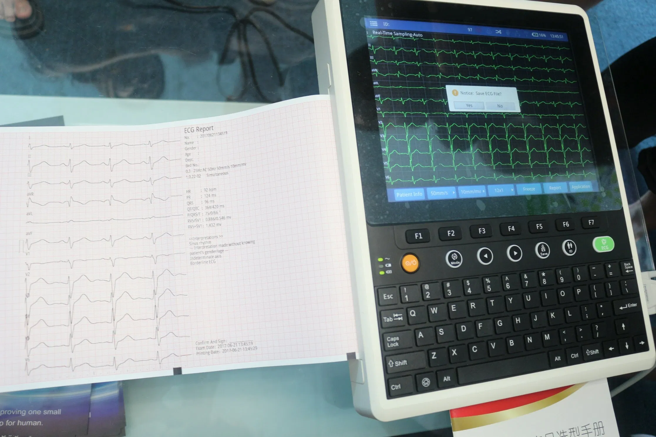 Ltse10 Precio de fábrica de equipos médicos 12-CH 10 Máquina de ECG de pulgadas para hospital