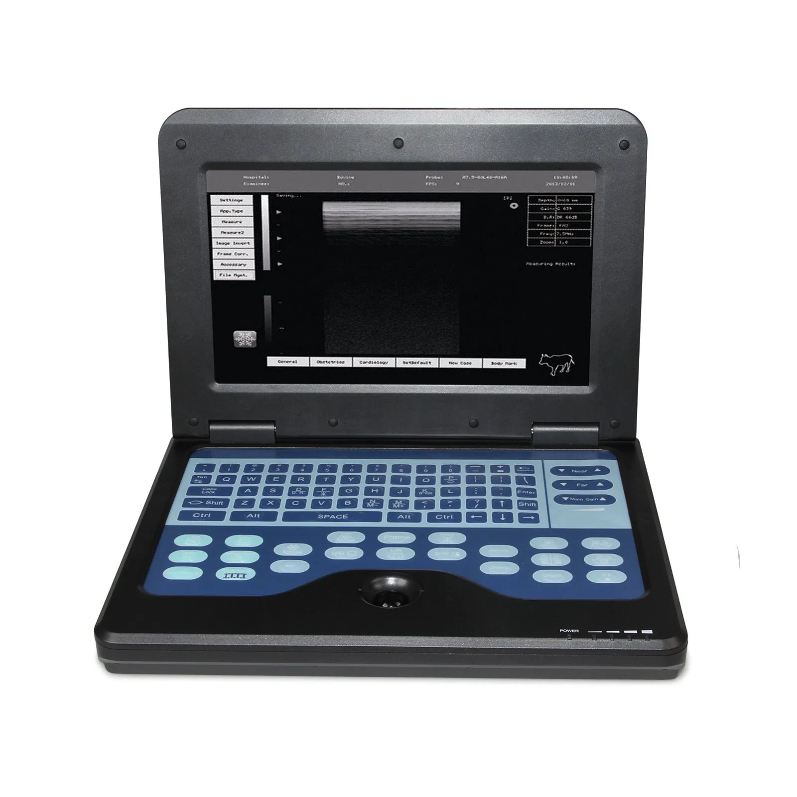 Sistema Avanzado de Ultrasonido Veterinario: Contec Cms600p2vet Imágenes de Precisión