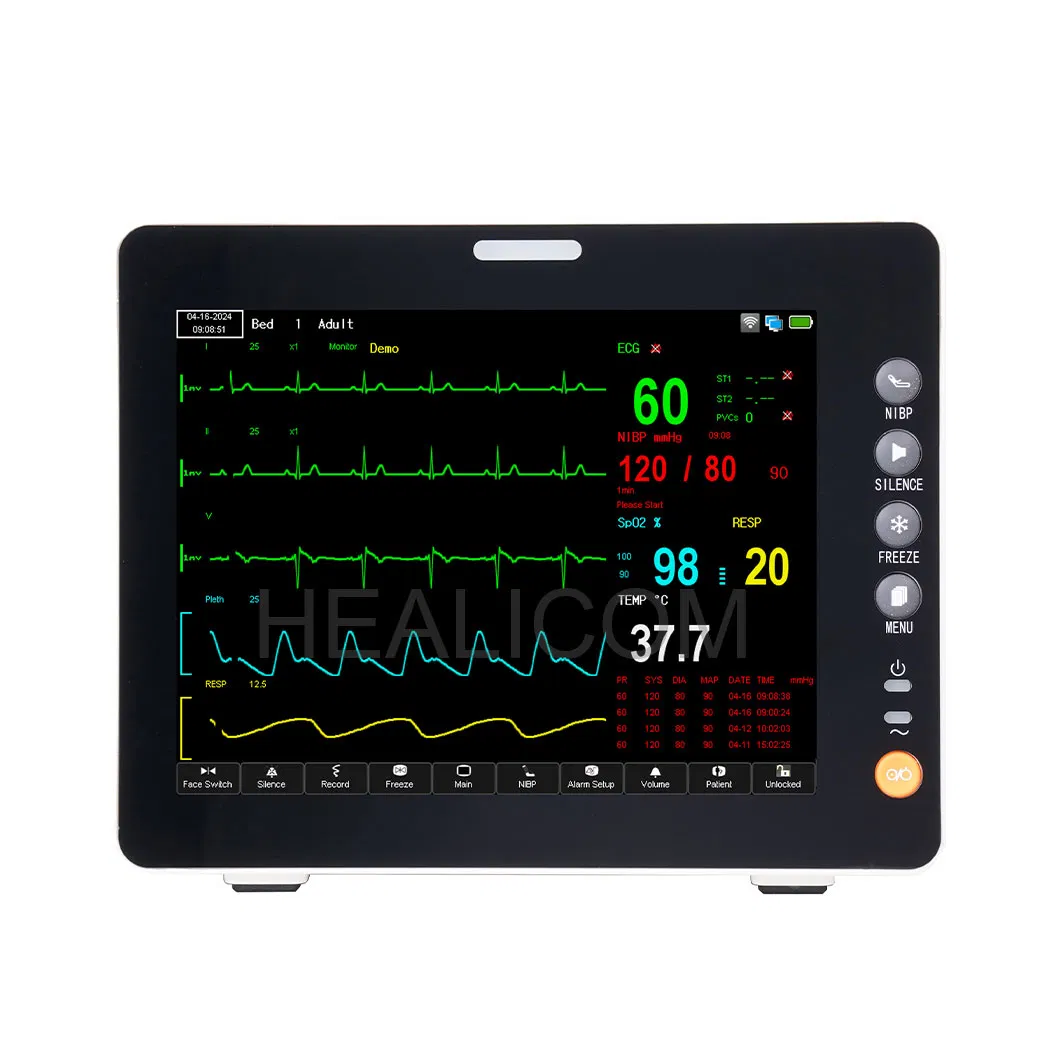 Visualización de formas de onda ECG de múltiples derivaciones en monitor de paciente multiparamétrico