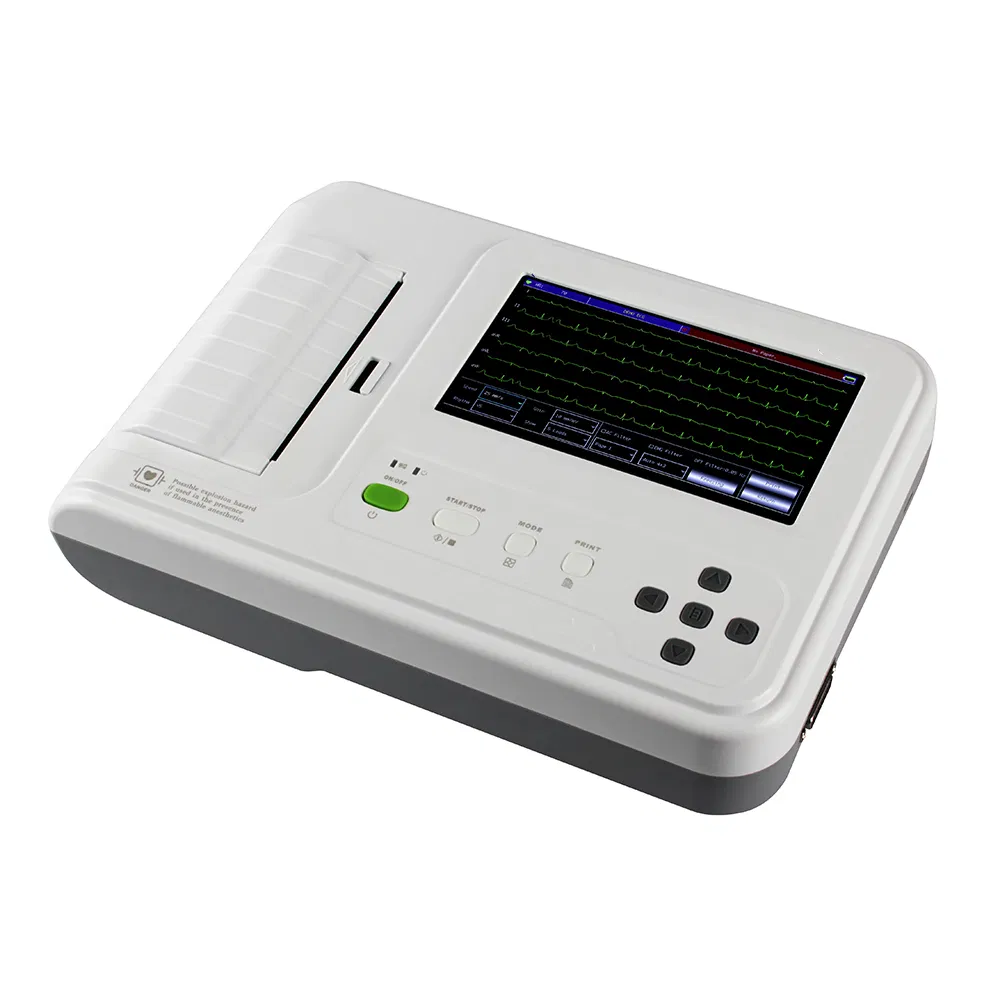 Máquina de Electrocardiografía ECG Basada en PC a Precio Económico 12 Leads 6 Canales con Análisis Diagnóstico en Tiempo Real