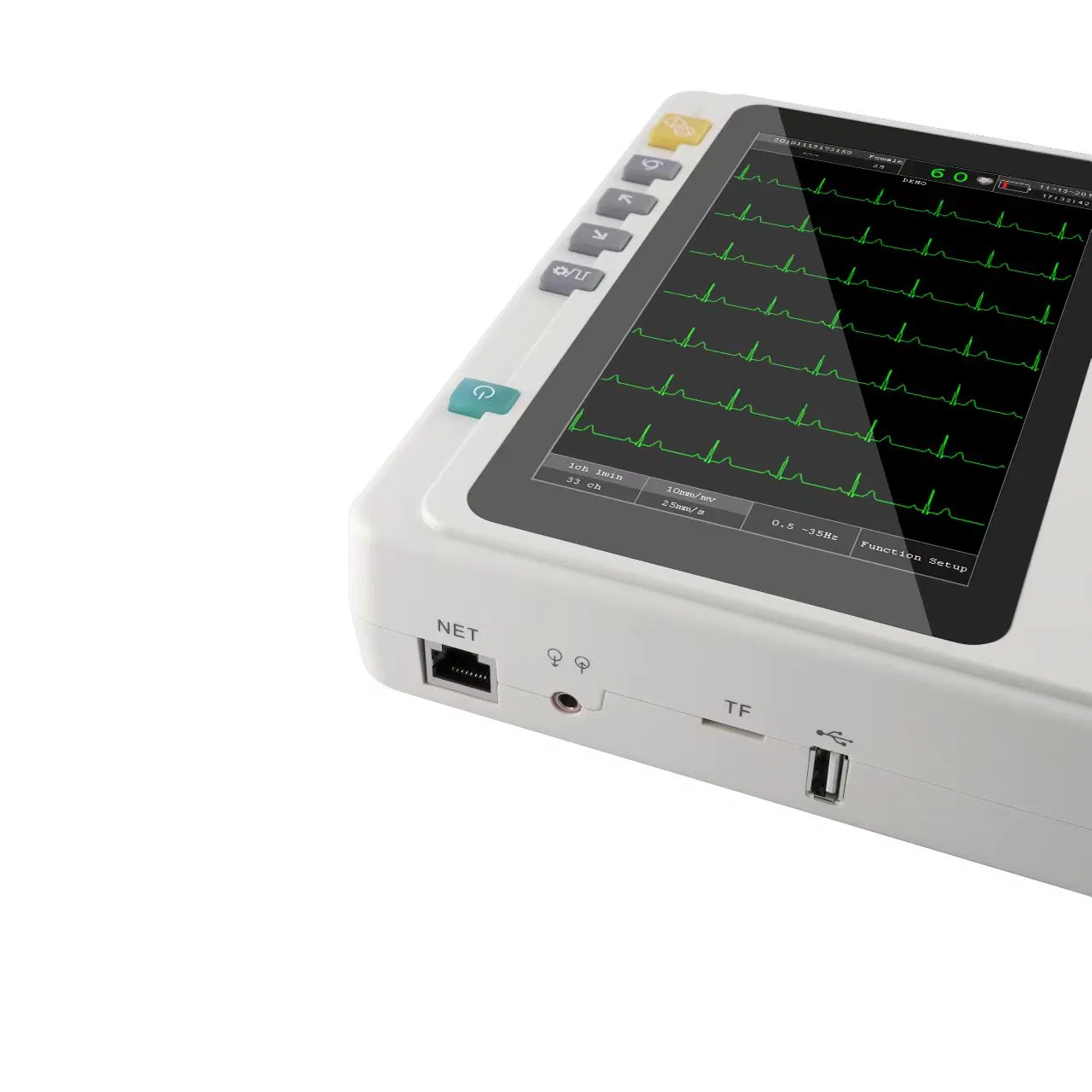 IN-601 Máquina de EKG ECG Digital Portátil Mayorista 3/6 con Software de PC y Pantalla Táctil