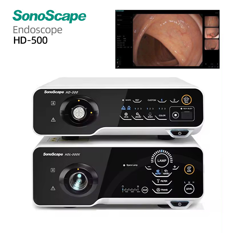 Sistema de Endoscopia Hospitalaria Sonoscape Certificado CE HD-500 Versátil Inteligente de Tinción Potenciado para Exámenes Gi Mínimamente Invasivos