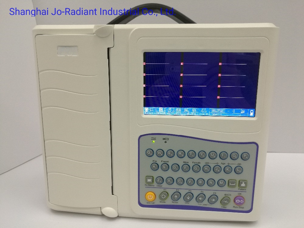 Monitor Electrocardiográfico Digital Portátil