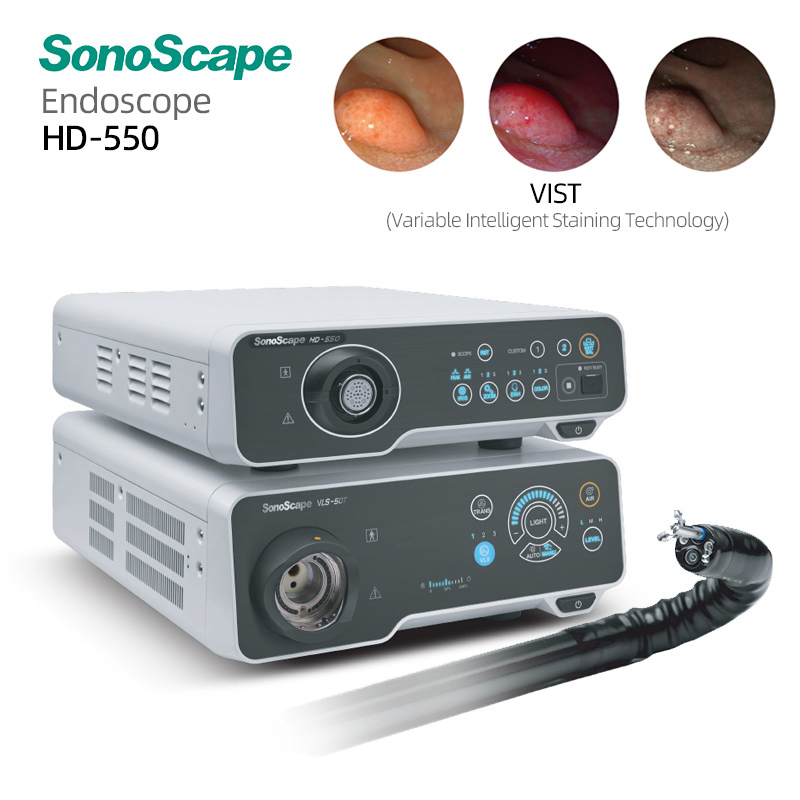 Sistema de Endoscopia Médica Sonoscape HD-550 con Sensor CMOS de Iluminación LED para Diagnóstico Gástrico 4 Full HD 1080P