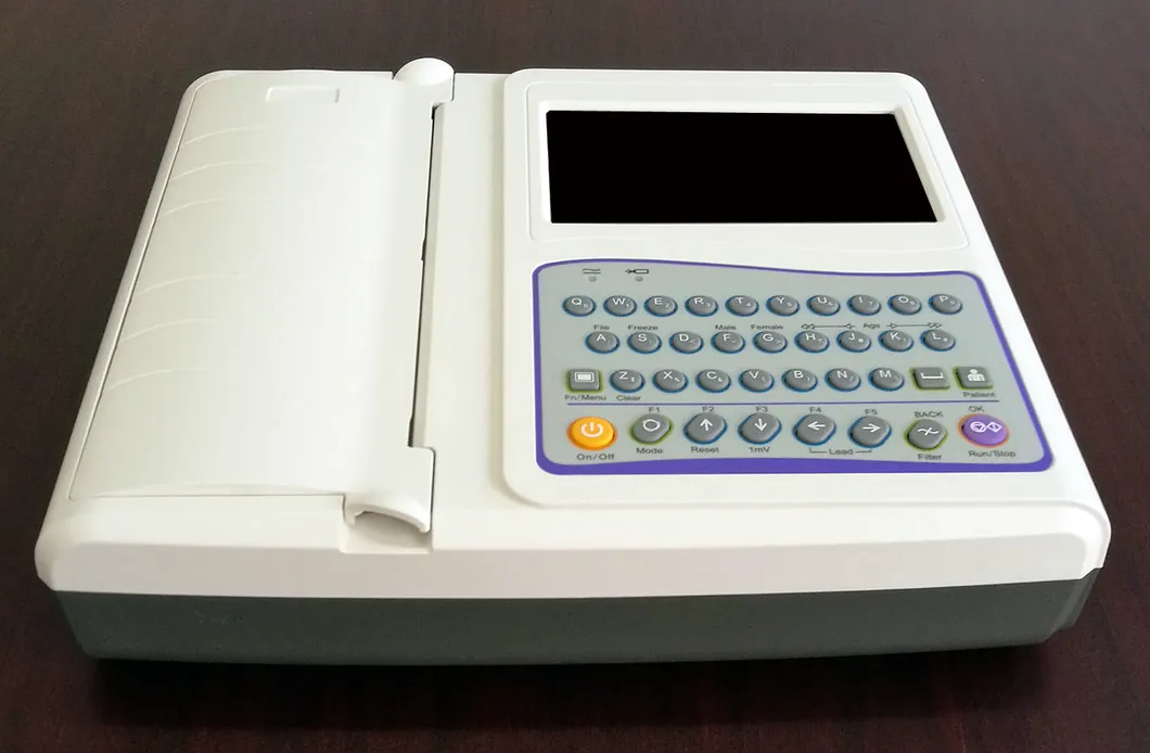 Vista ECG 1