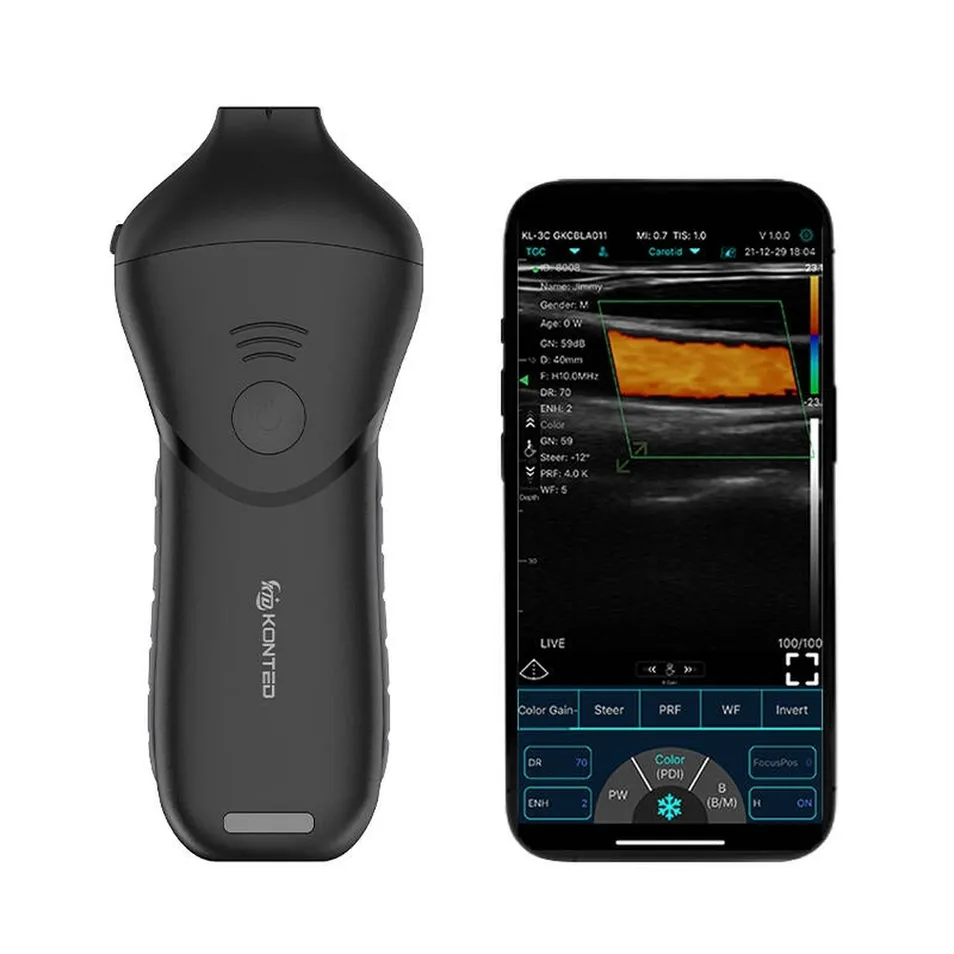 Handheld Ultrasound