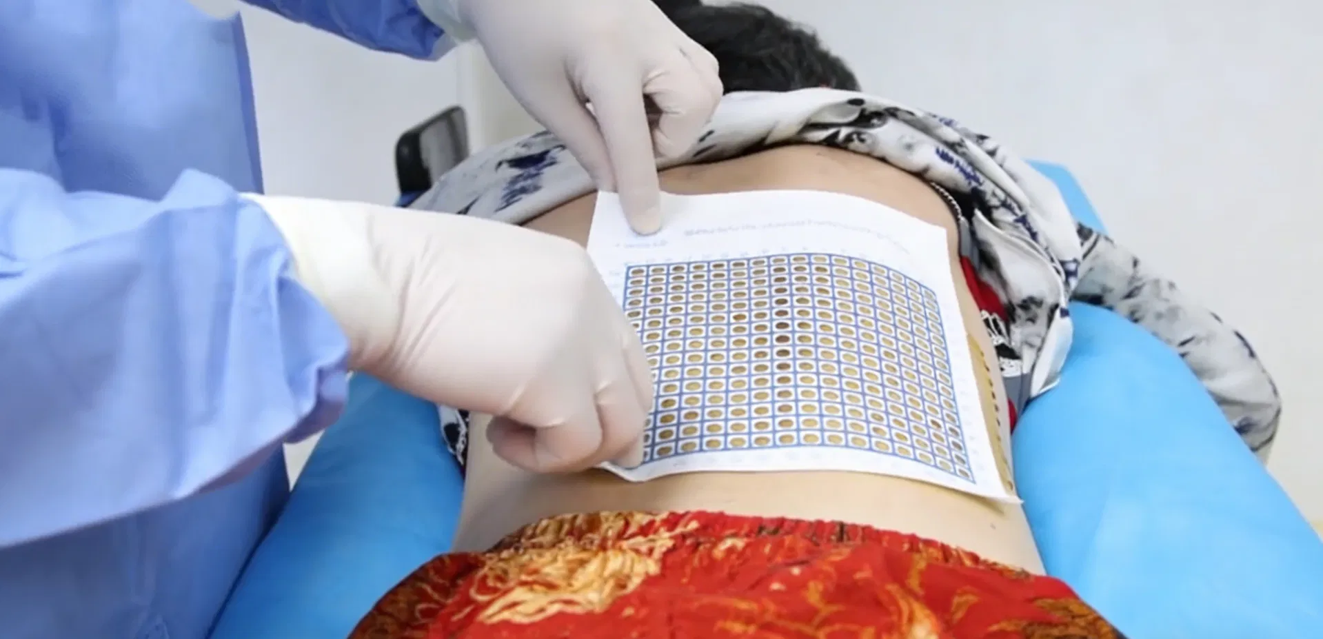 CT Biopsy Grid Overview